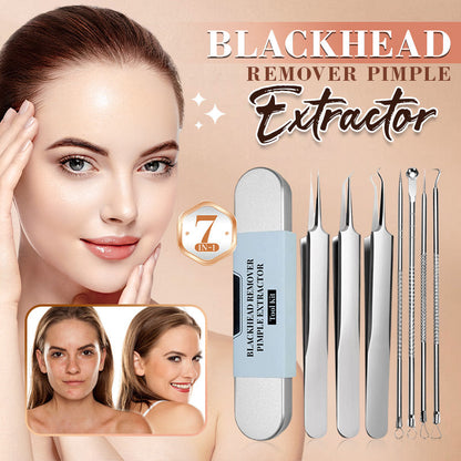 💓HOT SALE 50% KIADÓ💥Stainless Steel Blackhead eltávolító eszközkészlet